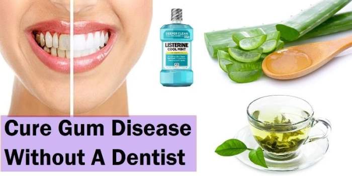 How to Conquer Gum Disease: A Guide to Healing Your Gums Naturally